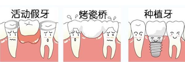 传统镶牙:影响真牙寿命
